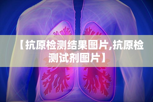 【抗原检测结果图片,抗原检测试剂图片】